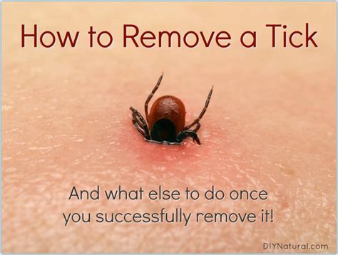 How to get a tick out - 